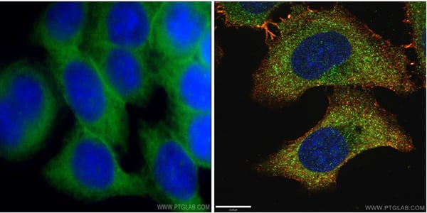 How to choose the right microscope setup for your experiment
