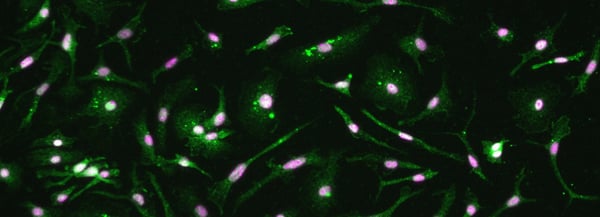 Rat and Mouse Microglia