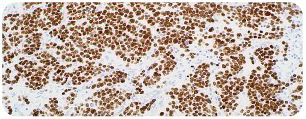 Pediatric Pathology