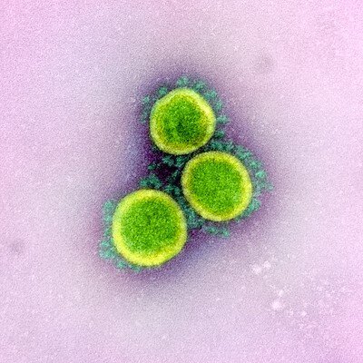Two new options for expressing SARS-CoV-2 Proteins
