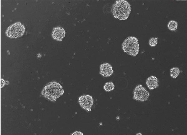 NEW: Ready-To-Use 3D Human Blood Brain Barrier Spheroid Kit with HBMEC