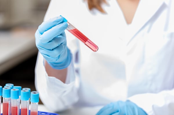 What is Flow Cytometry?