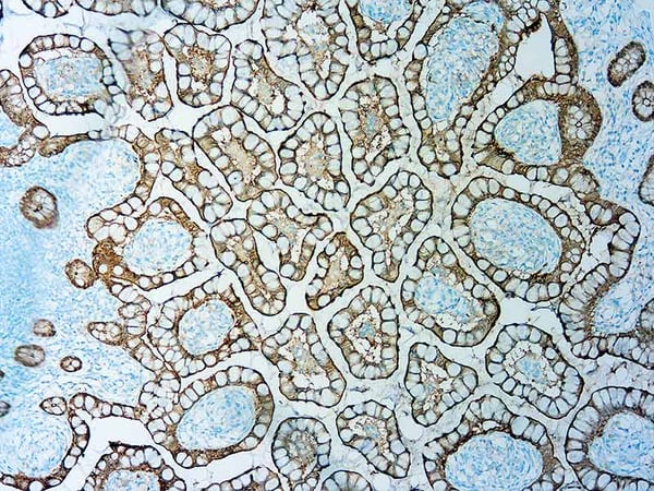 New DBS antibodies