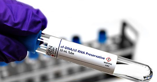 Liquid biopsy and cfDNA