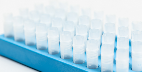 NTA-based Exosome Characterization