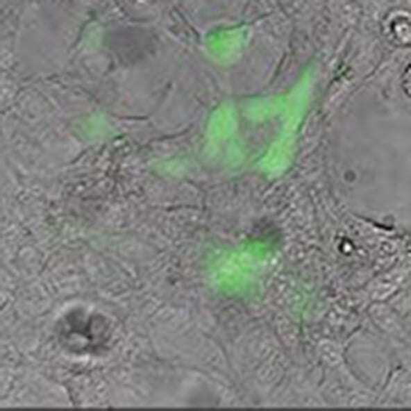 pPACK-SPIKE™ N501Y, SARS-CoV-2 “S” Pseudotype – N501Y Mutant – Lentivector Packaging Mix